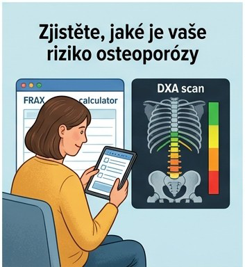 Ilustrace vyhodnocení rizika osteoporózy